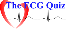 ECG Quiz
